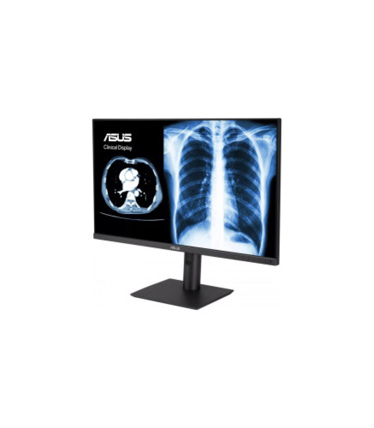 ASUS MONITOR ASUS MH2441A CLINICAL MONITOR – 24-INCH (23.8-INCH VIEWABLE), 3.6MP (2560 X 1440), AGLR, DICOM PART 14 GSDF, DICOM.