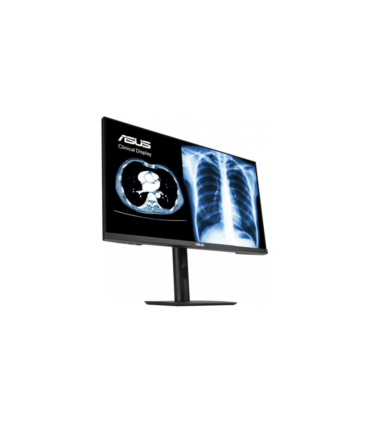 ASUS MONITOR ASUS MH2441A CLINICAL MONITOR – 24-INCH (23.8-INCH VIEWABLE), 3.6MP (2560 X 1440), AGLR, DICOM PART 14 GSDF, DICOM.