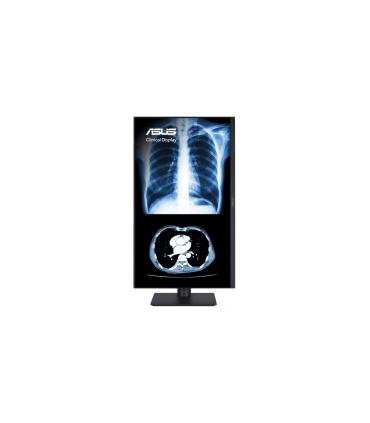 ASUS MONITOR ASUS MH2441A CLINICAL MONITOR – 24-INCH (23.8-INCH VIEWABLE), 3.6MP (2560 X 1440), AGLR, DICOM PART 14 GSDF, DICOM.