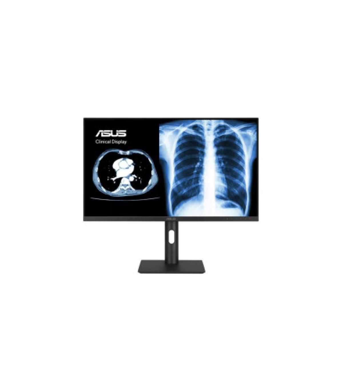 ASUS MONITOR ASUS MH2741A CLINICAL MONITOR – 27-INCH, 3.6MP (2560 X 1440), AGLR, DICOM PART 14 GSDF, DICOM PRESET, AUTO CALIBRAT