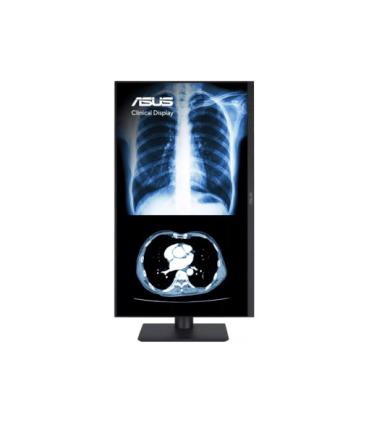 ASUS MONITOR ASUS MH2741A CLINICAL MONITOR – 27-INCH, 3.6MP (2560 X 1440), AGLR, DICOM PART 14 GSDF, DICOM PRESET, AUTO CALIBRAT