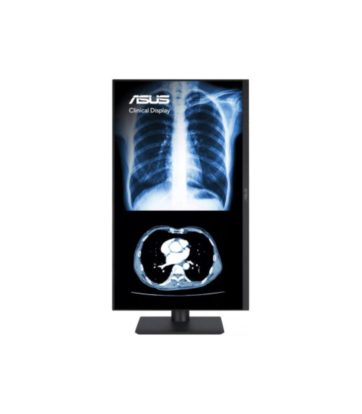 ASUS MONITOR ASUS MH2741A CLINICAL MONITOR – 27-INCH, 3.6MP (2560 X 1440), AGLR, DICOM PART 14 GSDF, DICOM PRESET, AUTO CALIBRAT